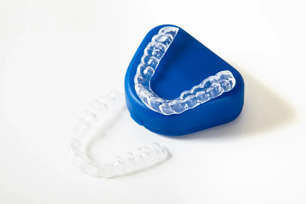 Invisalign, ¿cuánto tiempo tarda?